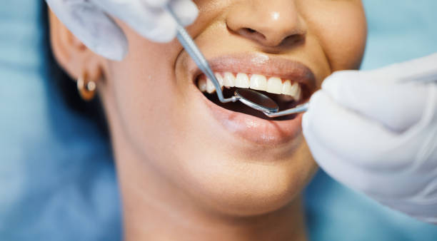 Best Emergency Root Canal Treatment in Carter Lake, IA